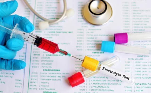 Poză ELECTROLITII - singurul supliment ESENTIAL